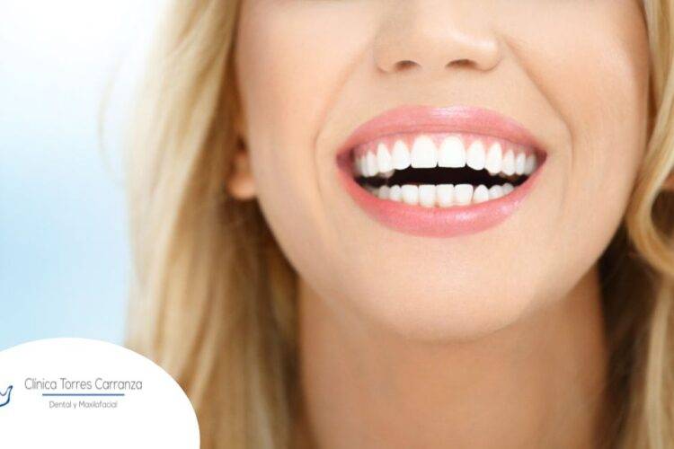 ¿De qué trata el diseño digital de sonrisas?