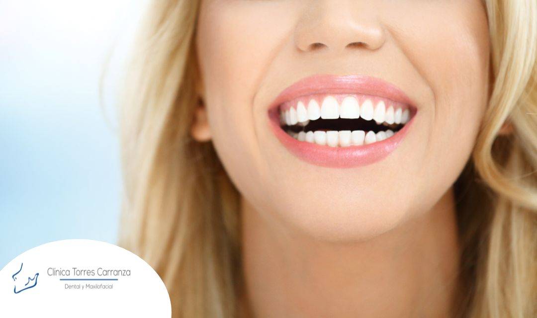 ¿De qué trata el diseño digital de sonrisas?