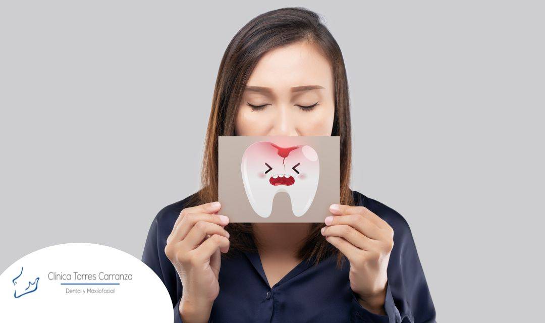 ¿Cómo se desarrollan las caries?